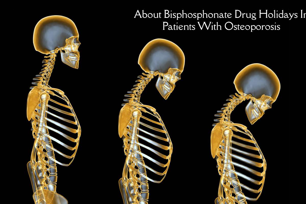 Bisphosphonate Drug Holidays in Osteoporosis Patients