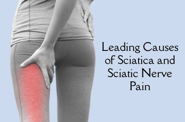 Leading Causes of Sciatica and Sciatic Nerve Pain