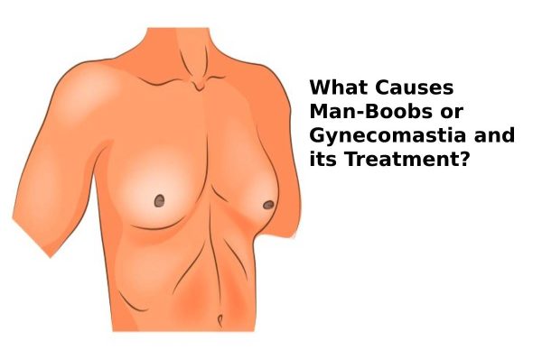 What Causes Man-Boobs or Gynecomastia and its Treatment?
