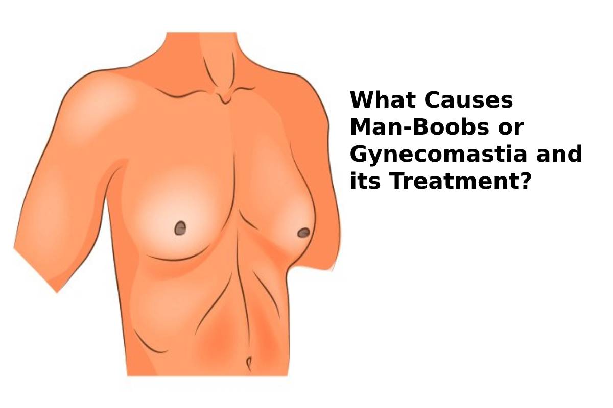 Man-Boobs or Gynecomastia and its Treatment – 2024