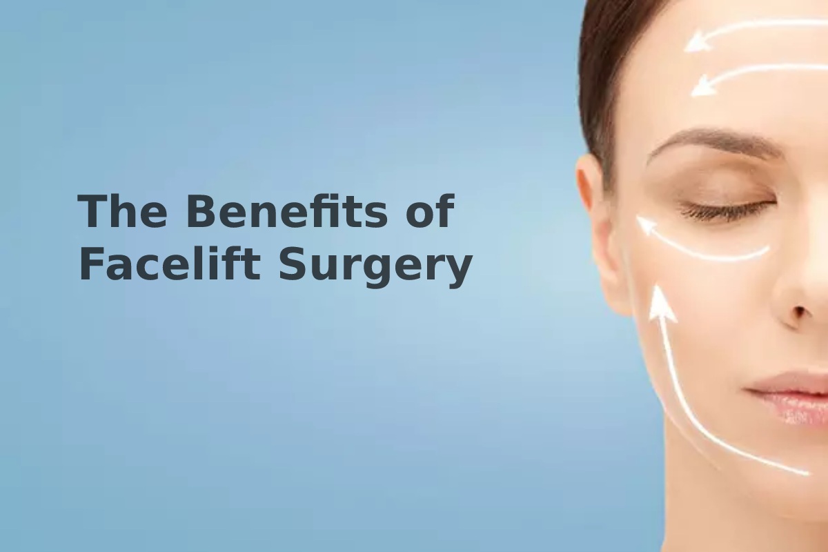 The Benefits of Facelift Surgery