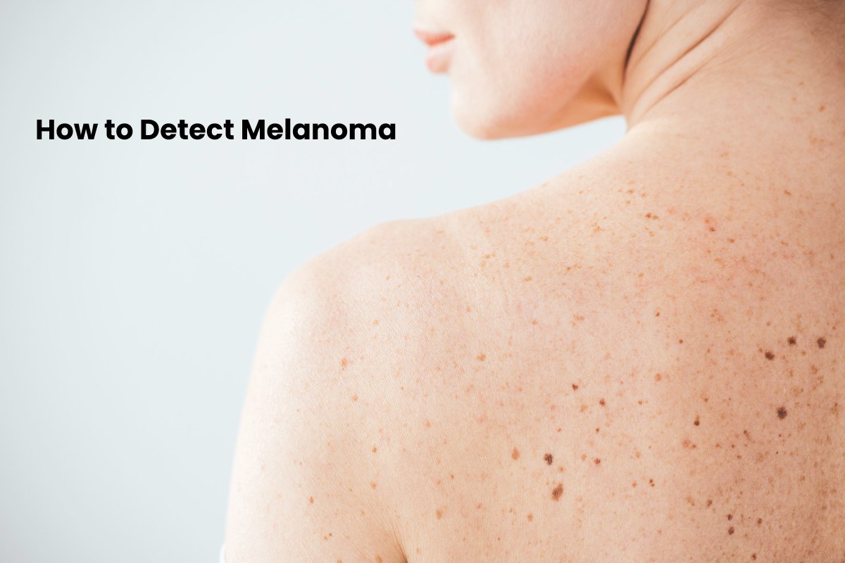 How to Detect Melanoma? – 2024