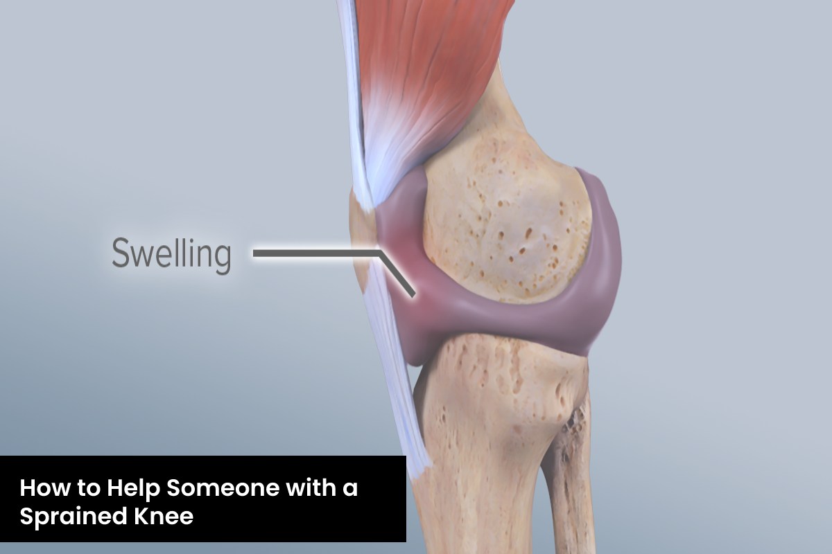 How to Help Someone with a Sprained Knee – 2024