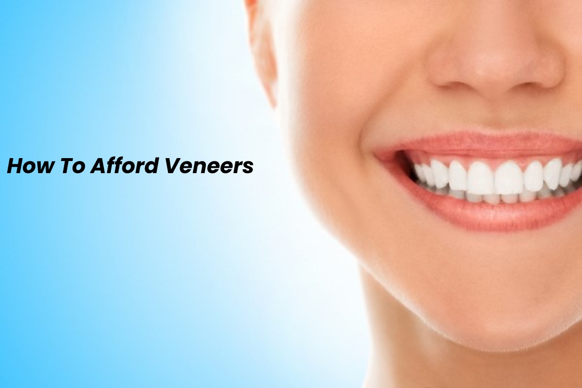 How to Afford Veneers in 2024