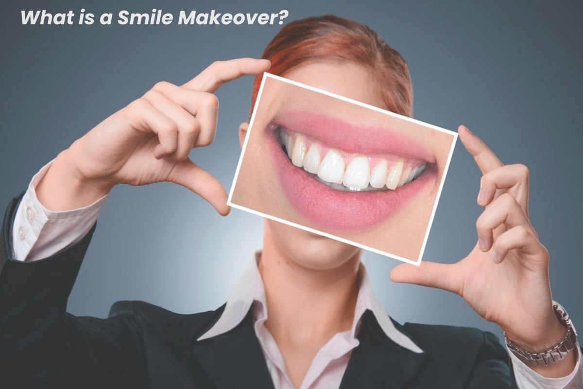 What is a Smile Makeover?