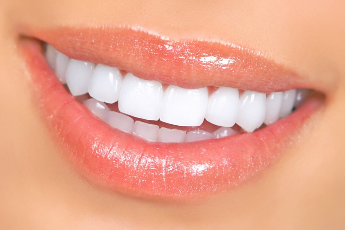 Top 10 Teeth Whitening Myths – 2023