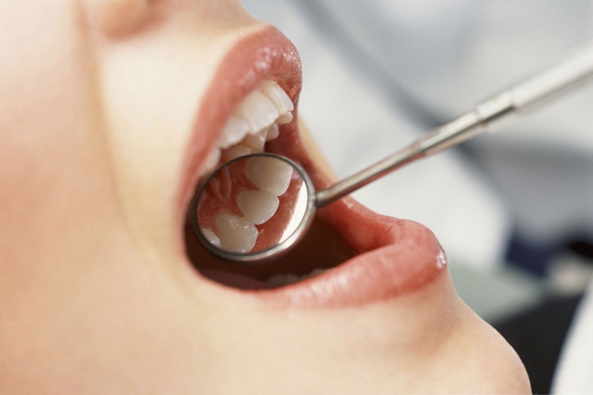 Top 7 Common Dental Problems – 2024