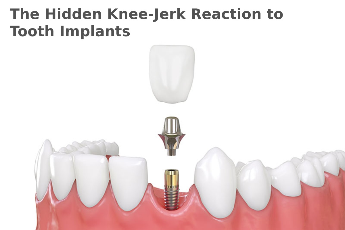 The Hidden Knee-Jerk Reaction to Tooth Implants – 2024
