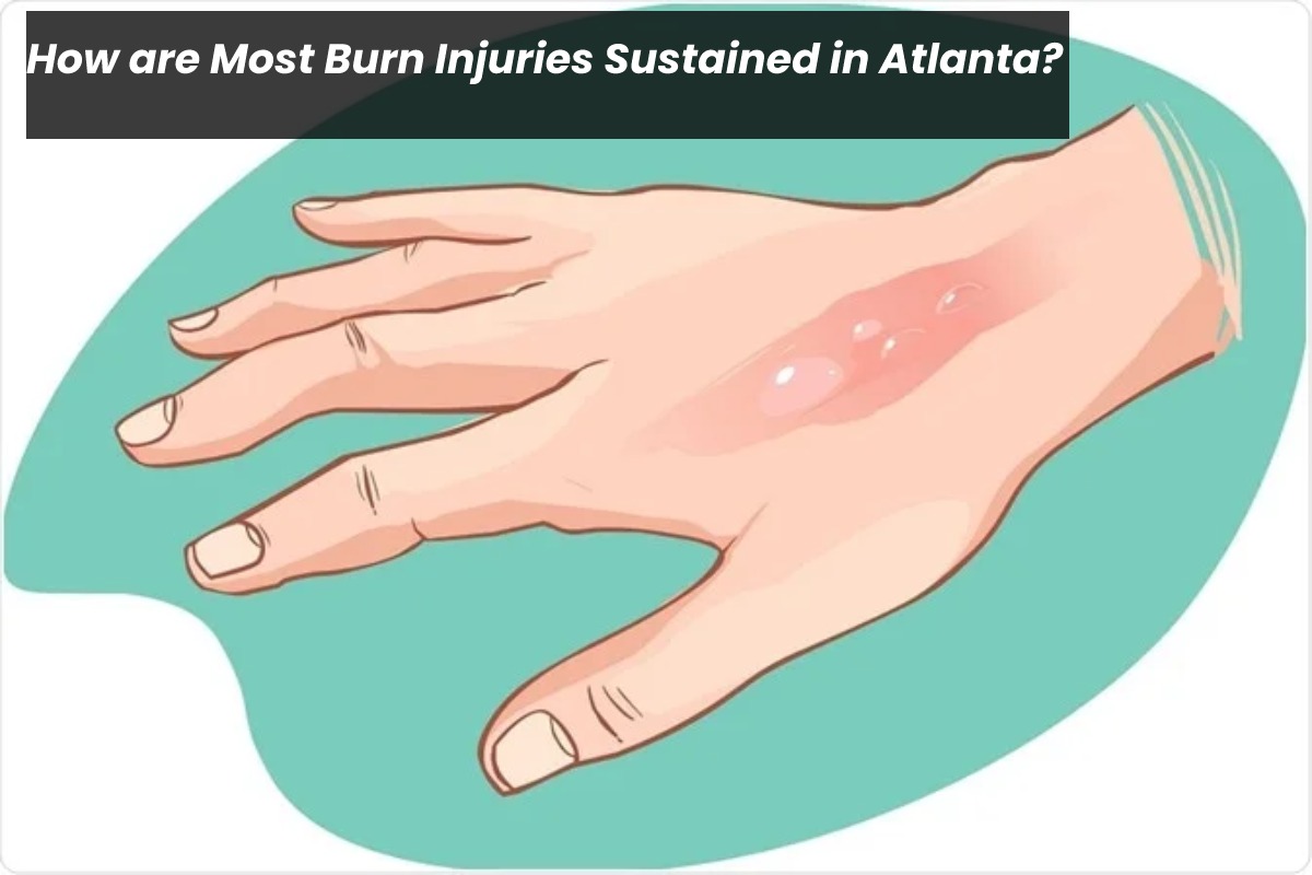 How are Most Burn Injuries Sustained in Atlanta?