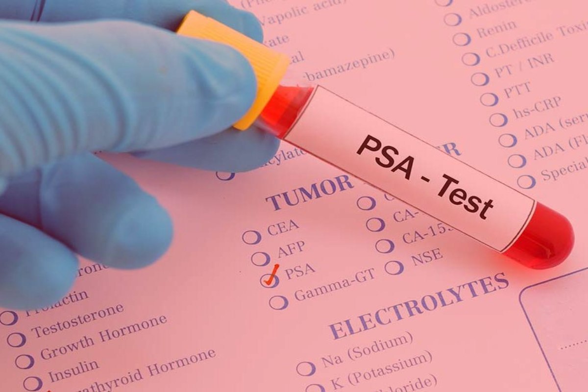 What is a PSA test and how to prepare for one? – 2024
