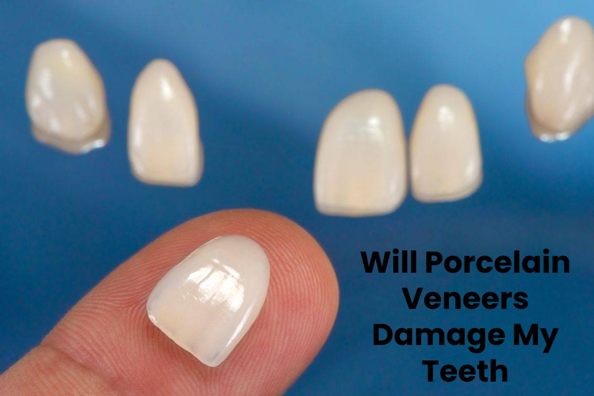 Will Porcelain Veneers Damage My Teeth? – 2024