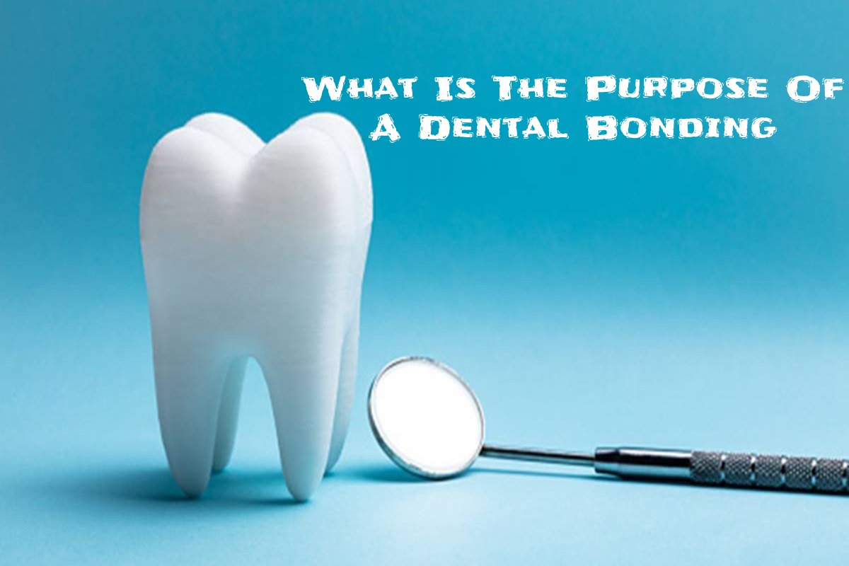 What is the Purpose of A Dental Bonding? – 2023