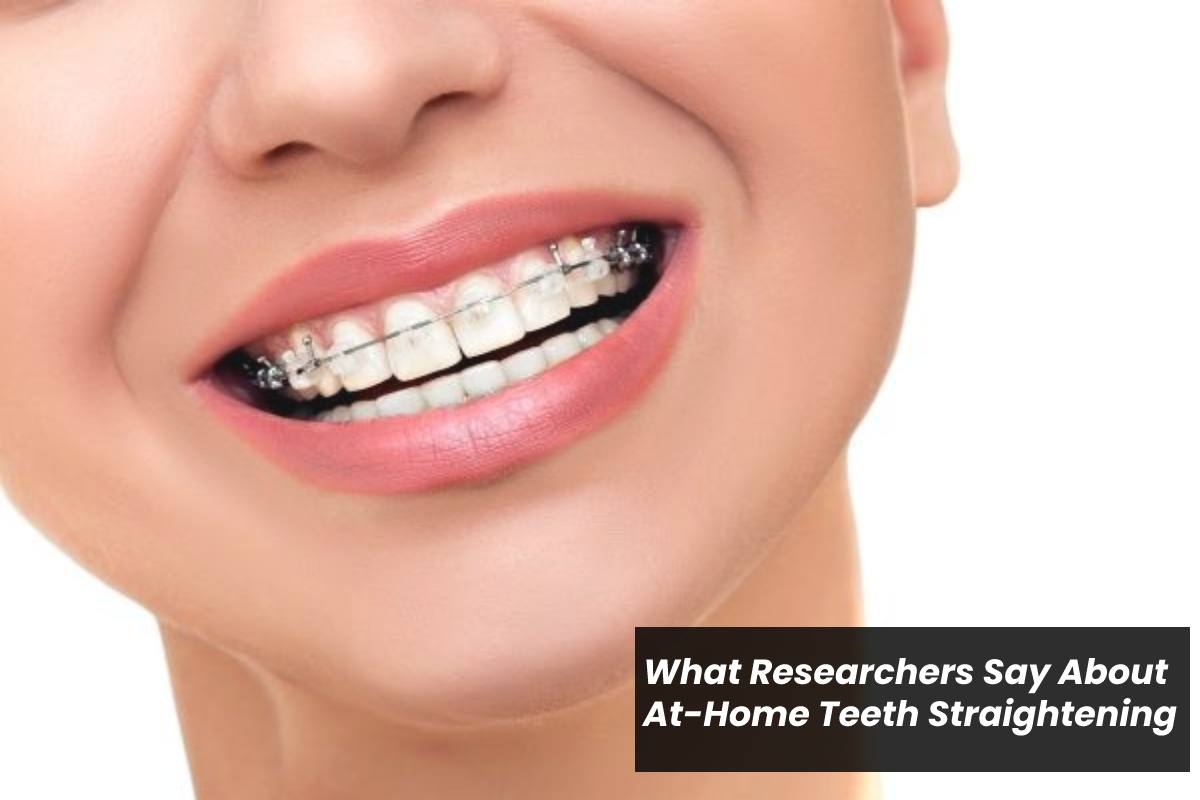 Researchers Say About At-Home Teeth Straightening – 2024