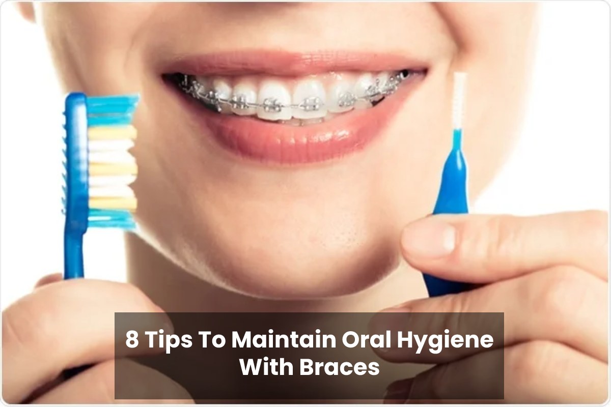 8 Tips To Maintain Oral Hygiene With Braces – 2024