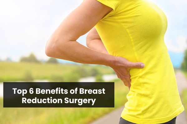 top 6 benefits of breast reduction surgery