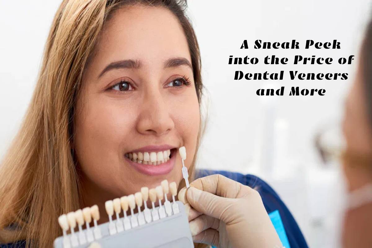 A Sneak Peek into the Price of Dental Veneers and More – 2023