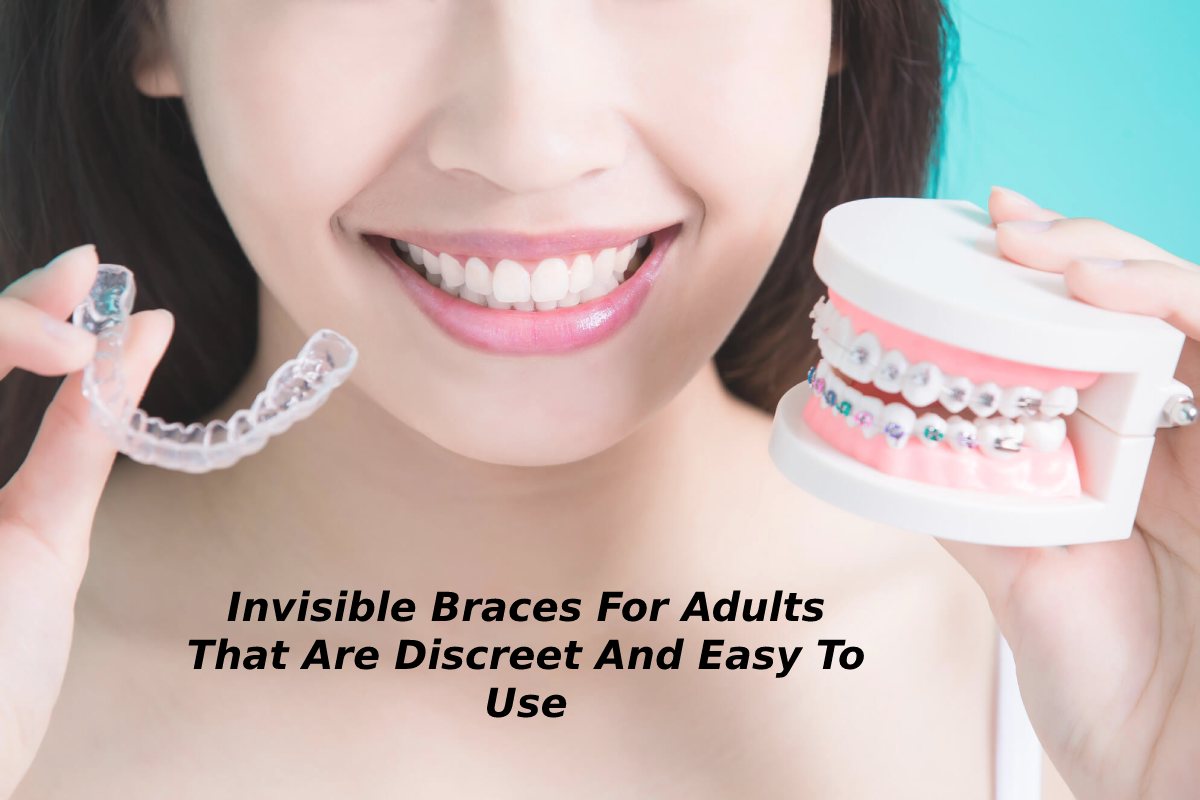 Invisible Braces For Adults That Discreet And Easy To Use – 2023