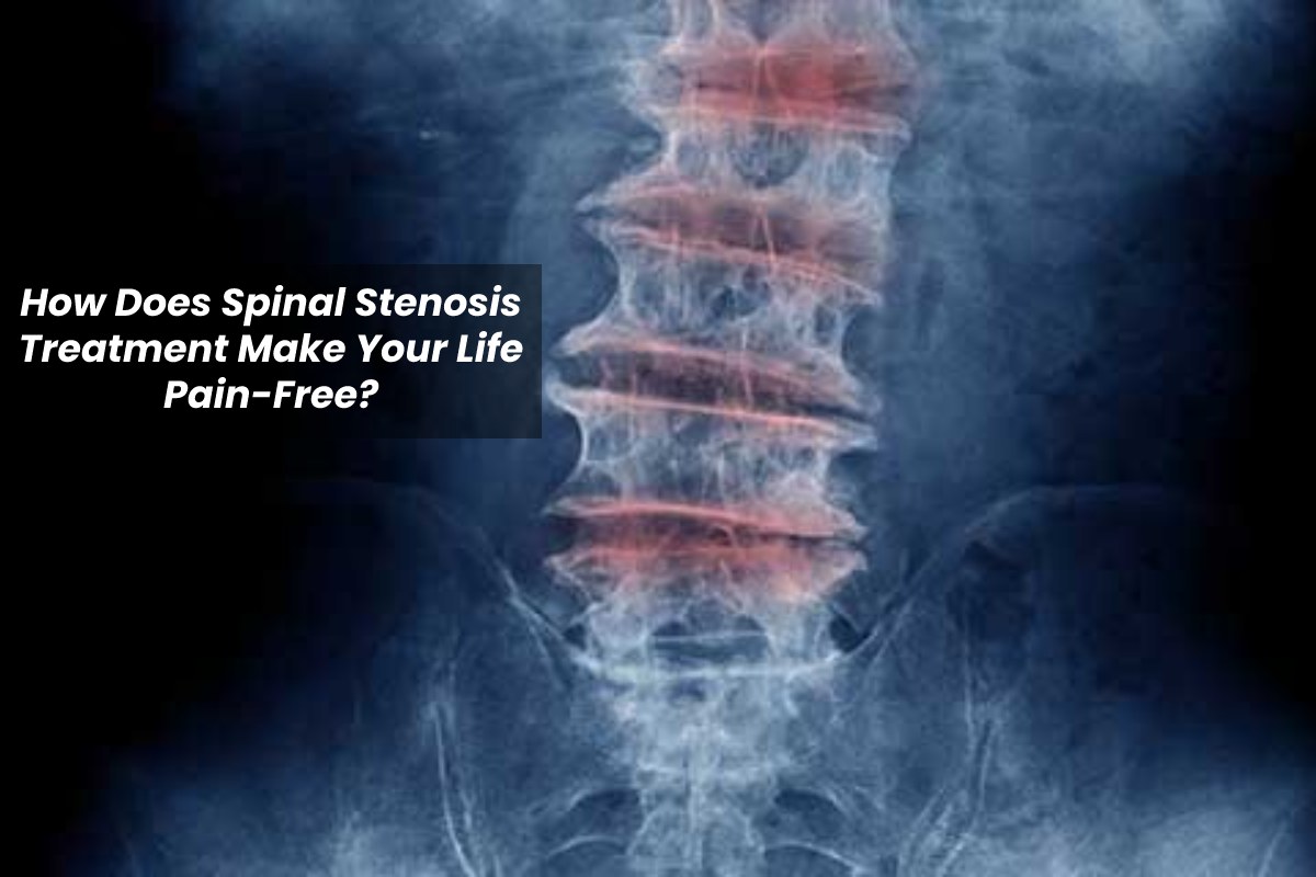 Spinal Stenosis Treatment Make Your Life Pain-Free – 2024