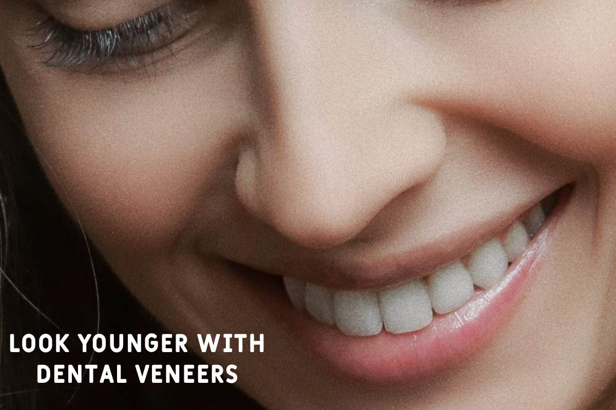 Look Younger With Dental Veneers – 2024