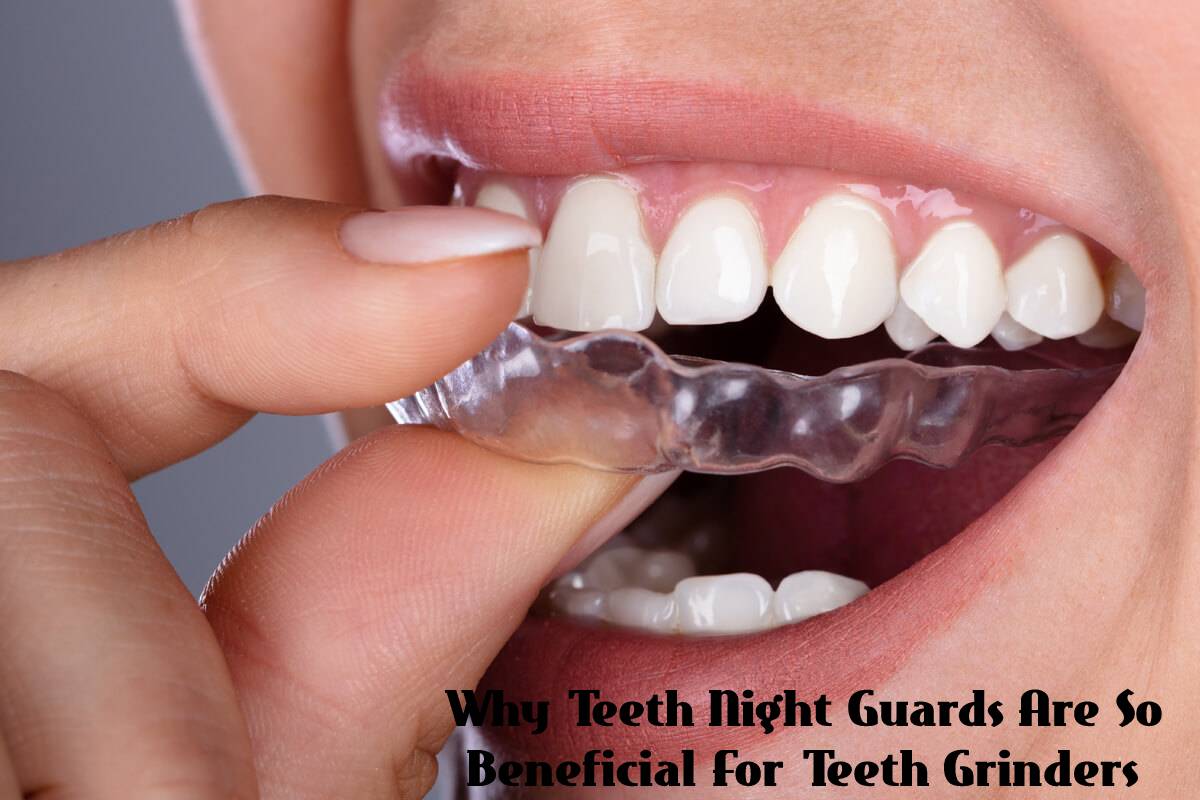 Why Night Guards Are So Beneficial For Teeth Grinders -2024