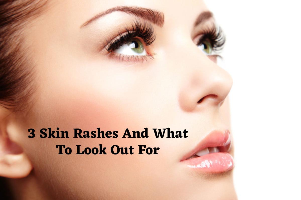 3 Skin Rashes And What To Look Out For