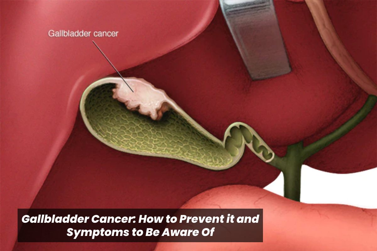 Gallbladder Cancer – Causes, Symptoms, and More – 2024