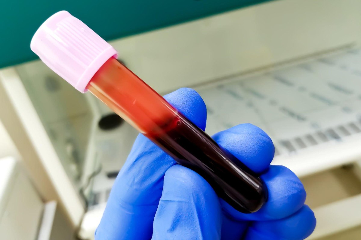 Your Complete Guide to Blood Test Types – 2023
