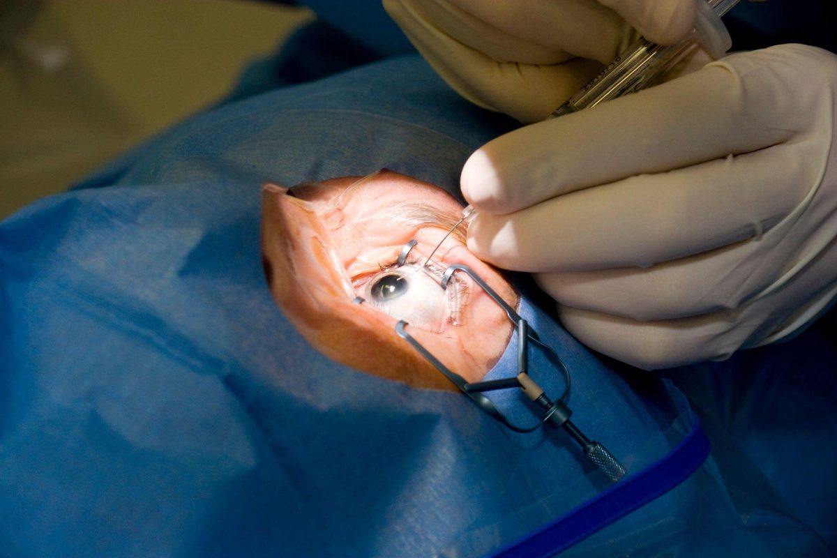 What Should You Expect During a LASIK Surgery? – 2024