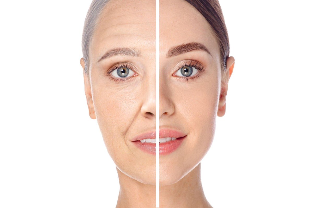 Wellhealthorganic.Com:Facial-Fitness-Anti-Aging-Facial-Exercises-To-Look-Younger-Every-Day