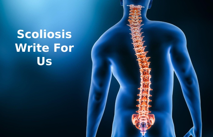 Scoliosis Write For Us