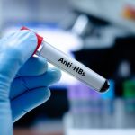 Anti Hbs (Mikropartikül Immün Assay-Meia Veya Benzeri)