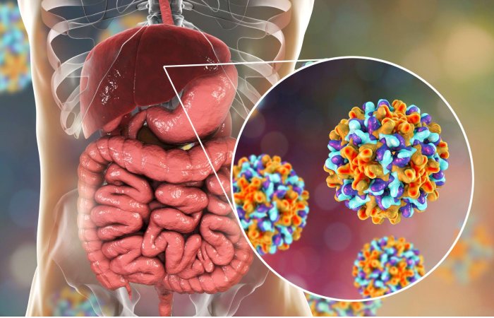 Hepatitis B Virus Infection