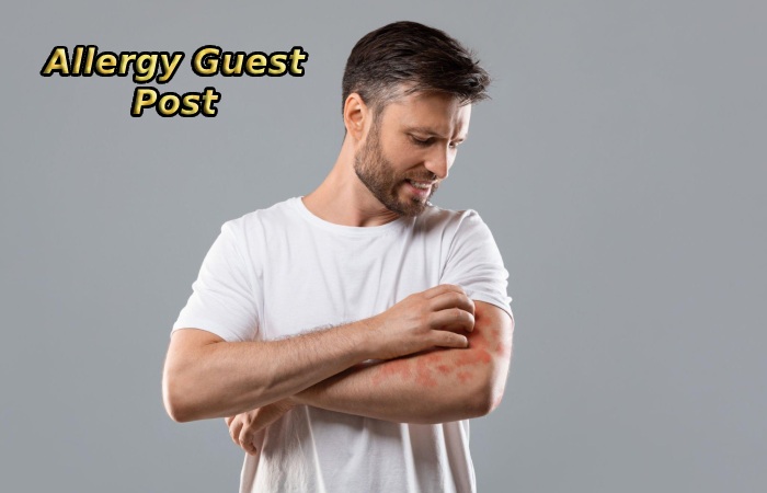 Allergy Guest Post