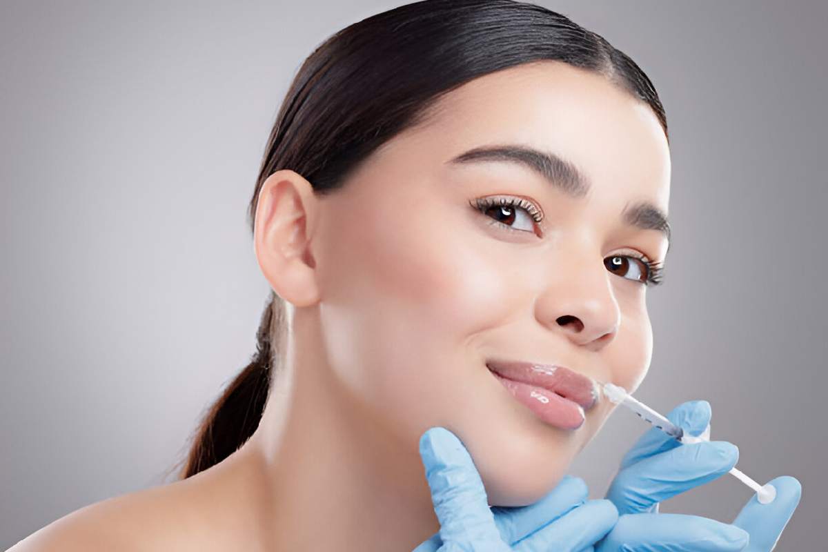 Things To Keep In Mind Before Getting A Botox Lip Flip