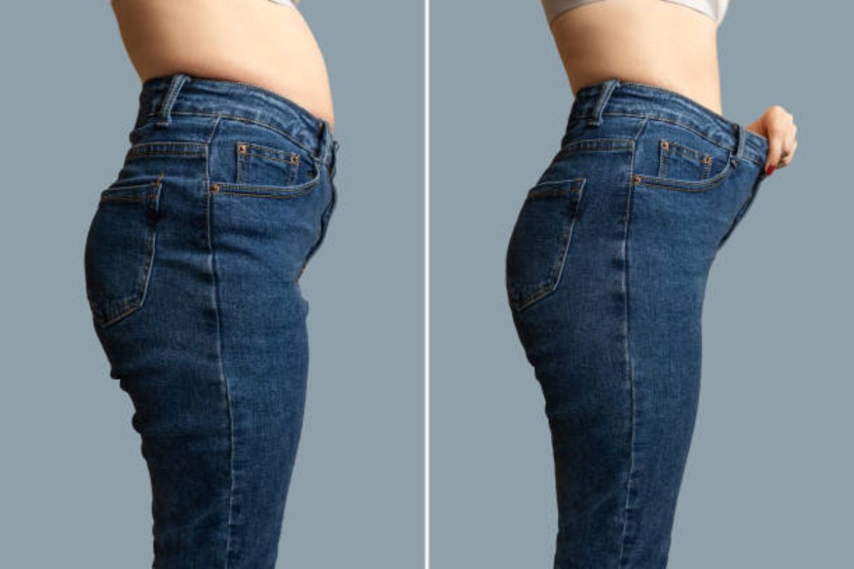 Transform With a Tummy Tuck in Dallas, TX