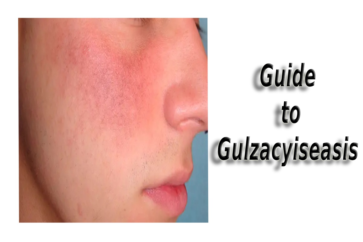 Gulzacyiseasis: The Ultimate Guide to Revolutionizing Solutions