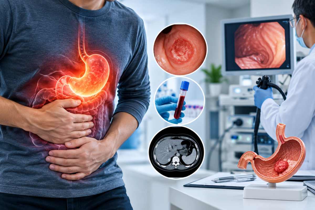 Stomach Cancer Diagnosis: Tests, Symptoms and What to Expect